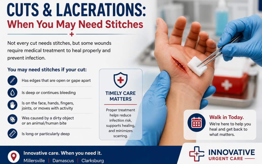 Cuts and Lacerations: When You May Need Stitches