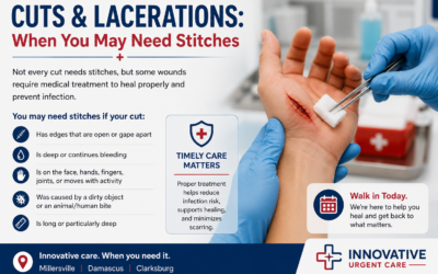 Cuts and Lacerations: When You May Need Stitches